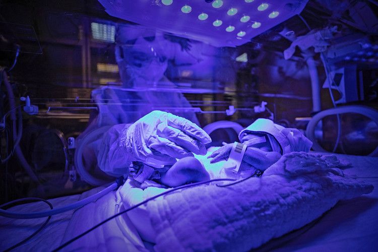 ZAPS to hold Gastroschisis Management workshop